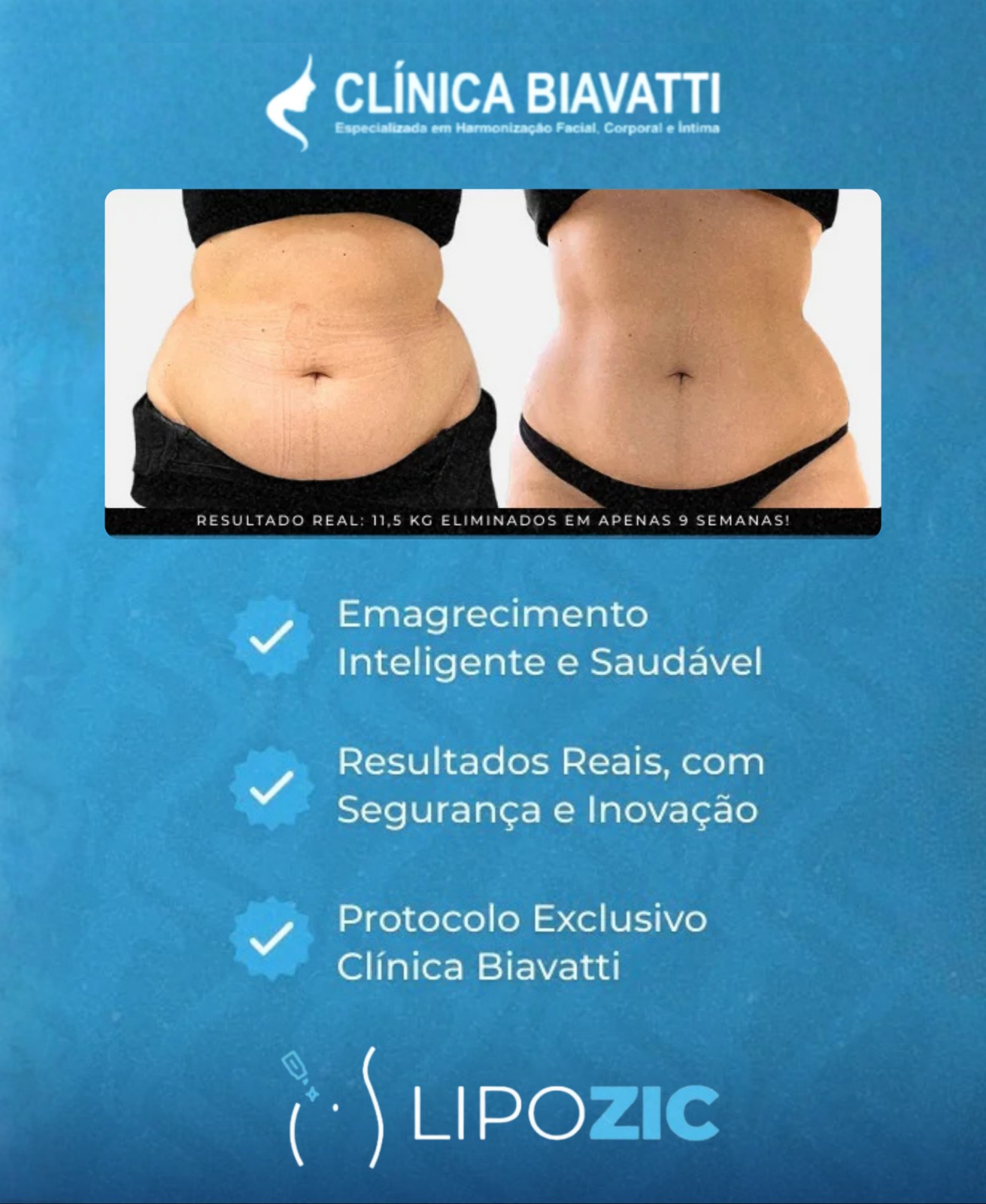 carousel-lipozic-DuvgTXsH